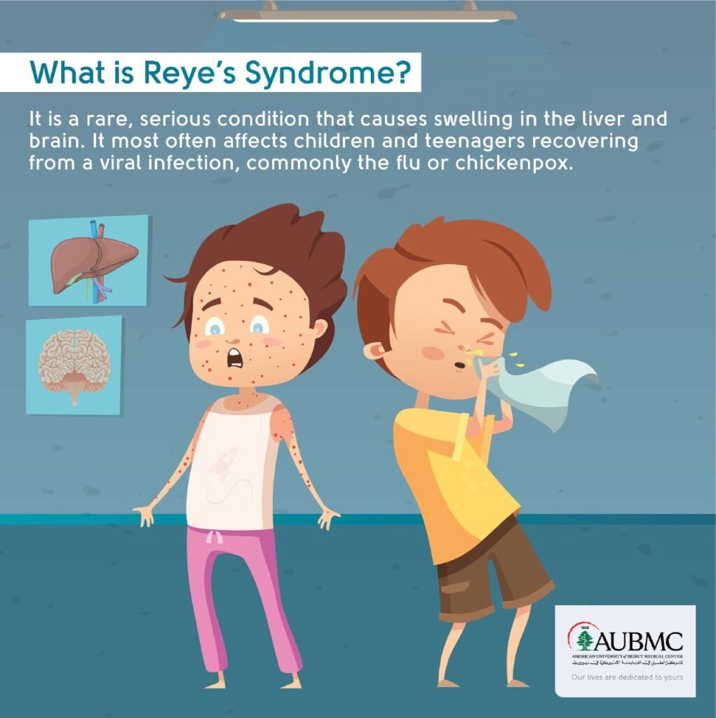 متلازمة راي