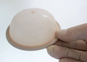 الحجاب المهبلي 