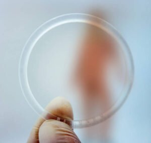 حلقات مهبلية